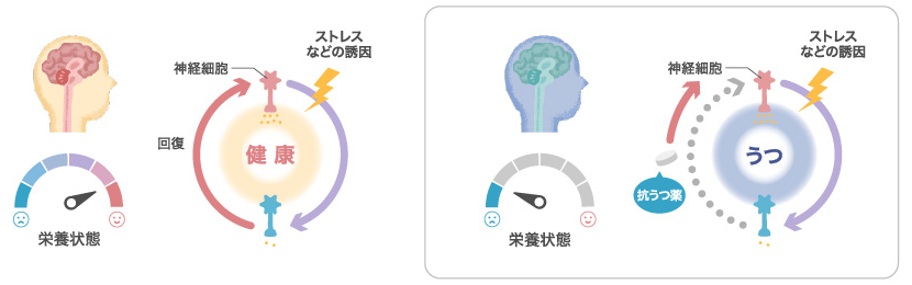 うつと栄養の関係